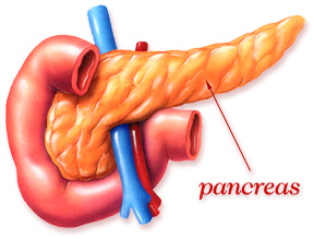 Early Pancreatic Cancer